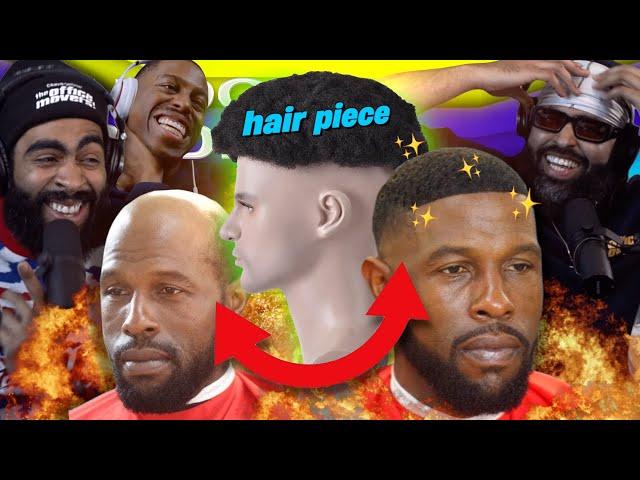 The Male Hair Piece Transformation ― RO Show 195