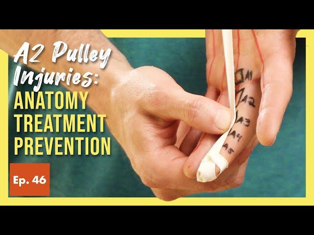 A2 Pulley Injuries: Everything Climbers Need to Know (STRAINS, TEARS, & SURGERY)