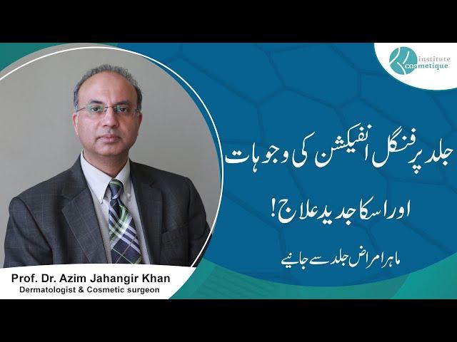 Fungal Infection Treatment - Types Of Fungal Infection -  Fungus Ka Ilaj - Prof Dr Azim | Cosmetique