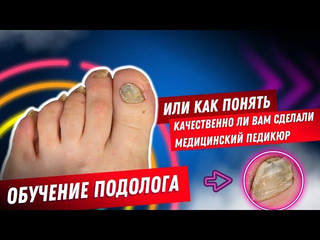 Обучение подолога / медицинской педикюр