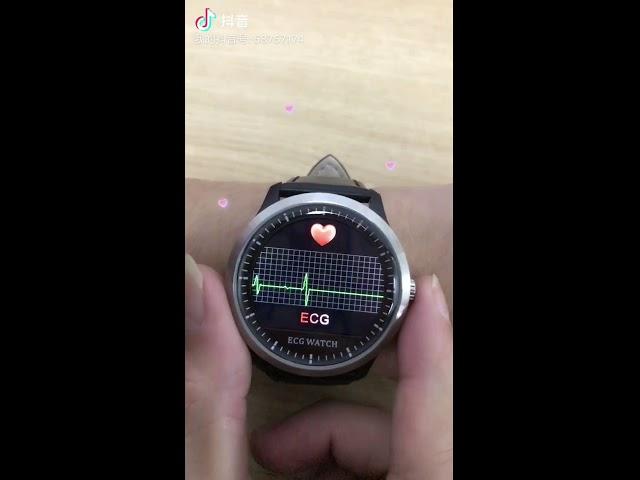 N58 Cardiogram Smart Bracelet ECG+PPG Monitoring HRV Report Blood Pressure Wristband