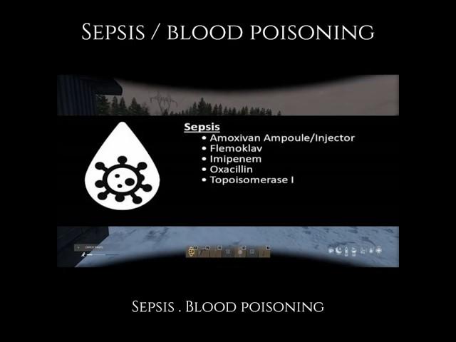 Sepsis on DayZ IntenZ server  #gaming #dayzsurvival #dayzgameplay #fps #survival #dayztips