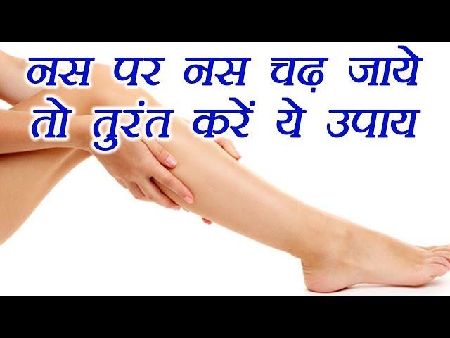 Muscle Cramps: नस पर नस चढ़ जाये तो तुरंत करें ये उपाय | Muscle Spasm Home Remedy | Boldsky