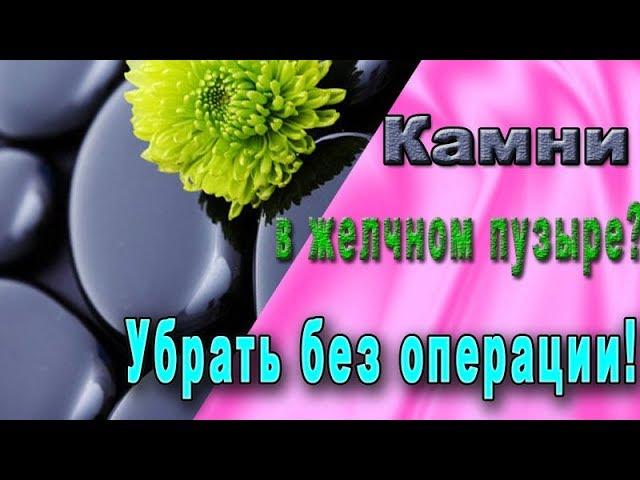 Камни в желчном пузыре. Как убрать без операции?