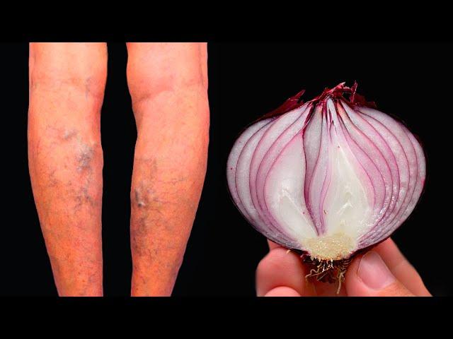 Unbelievable!It's a varicose vein killer! Erases varicose veins like an eraser!Top 5 recipes