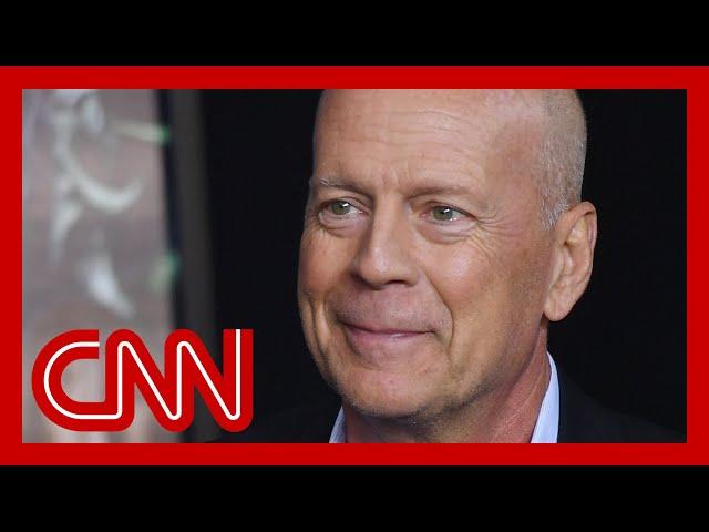 Doctor breaks down challenges Bruce Willis could face with diagnosis of FTD