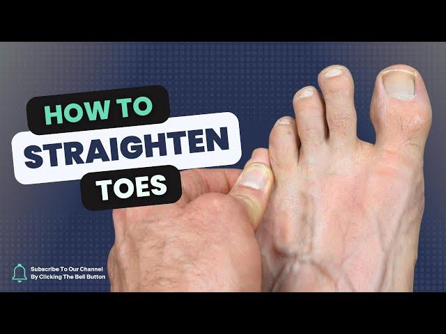 How to Straighten a Rotated Toe