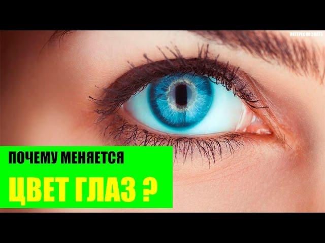 Почему меняется цвет глаз?