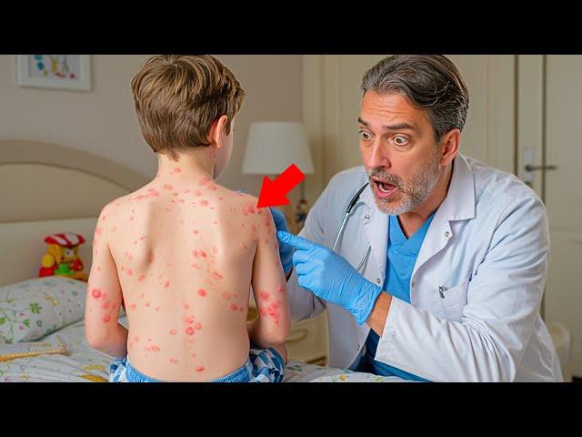 The Boy Thought He Had Bedbugs, But The Doctor Looked Closer And Was Horrified...