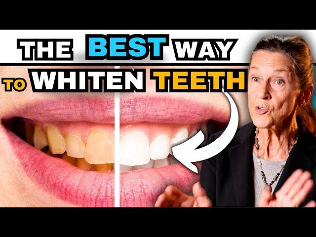 The BEST Way to Whiten Your Teeth (without ruining them)