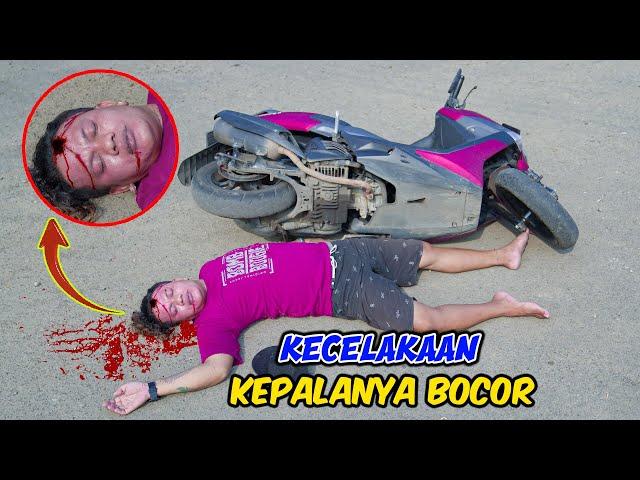 KASIHAN !!!  KEPALA TIMBUL BOCOR JATUH DARI MOTOR BARU