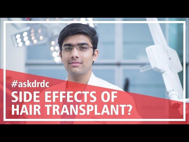 What is a hair transplant & side effects of hair transplant | HairMD, Pune