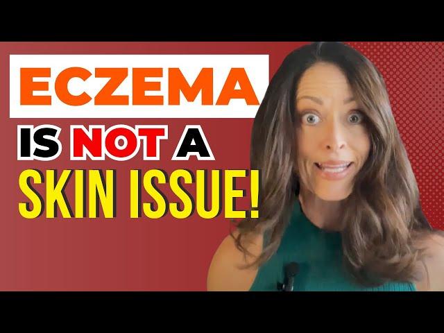 Eczema and the Gut | Getting to the Root Causes