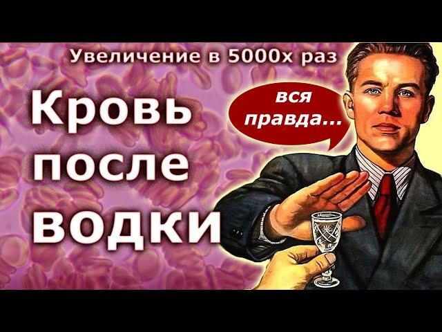 Кровь после водки - вся правда