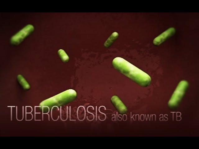 CDC Tuberculosis (TB) Transmission and Pathogenesis Video