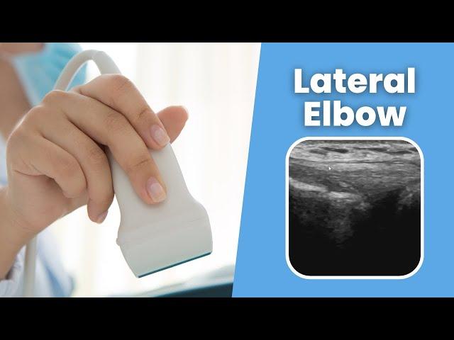 Lateral Elbow - MSKUS - How to scan the Lateral Elbow - 2 minute tuesday