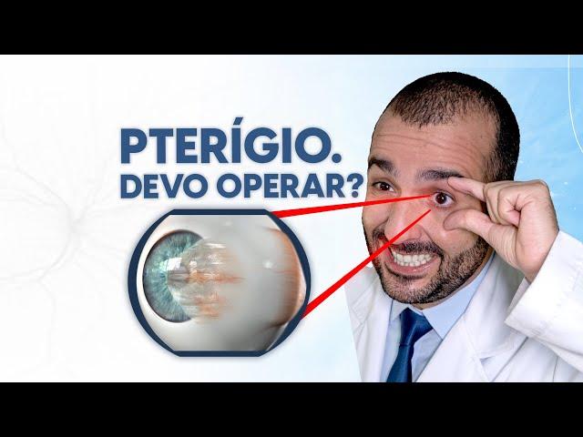 Pterígio: precisa de cirurgia? Como tratar? • Dr. Gustavo Bonfadini