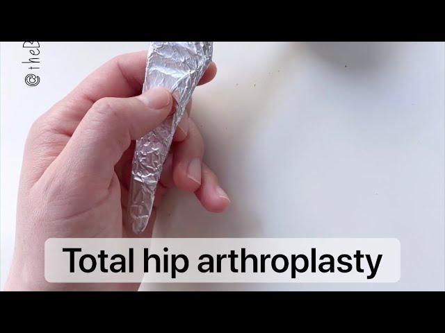 Playdough Surgery - Total Hip Replacement