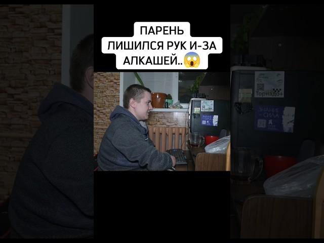 Парень в 16 лет лишился рук..