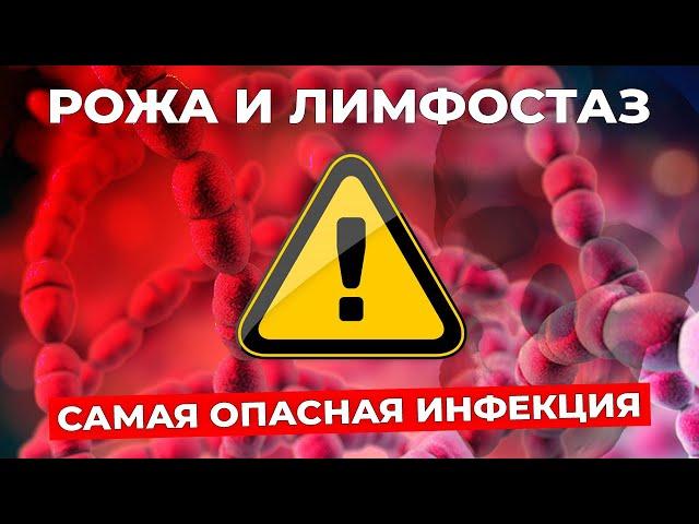 РОЖА: почему возникает при отеке и чем рискует пациент с лимфостазом