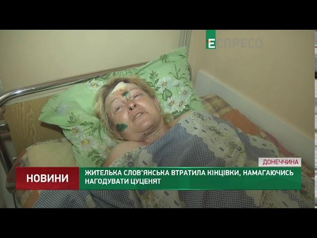 Жителька Слов’янська втратила кінцівки, намагаючись нагодувати цуценят