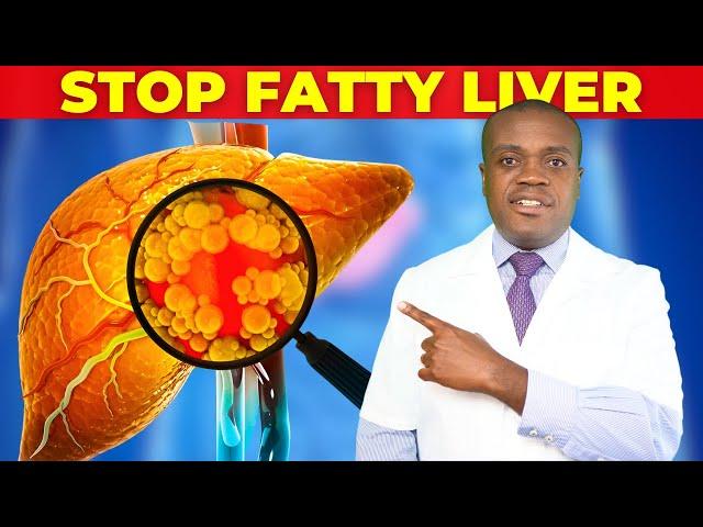 8 Worst Foods For Fatty Liver And Insulin Resistance