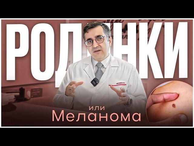 Родинки или меланома? Как разобраться и не пропустить рак