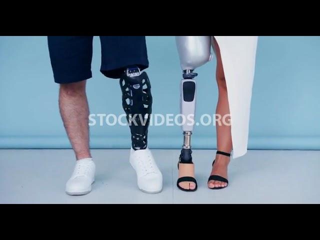 amputee couple man & woman with prosthet...