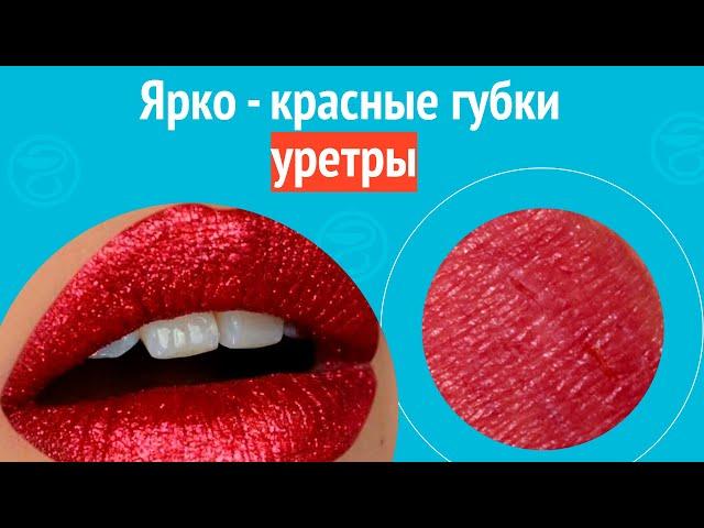  Ярко - красные губки уретры. Клинический случай №1573