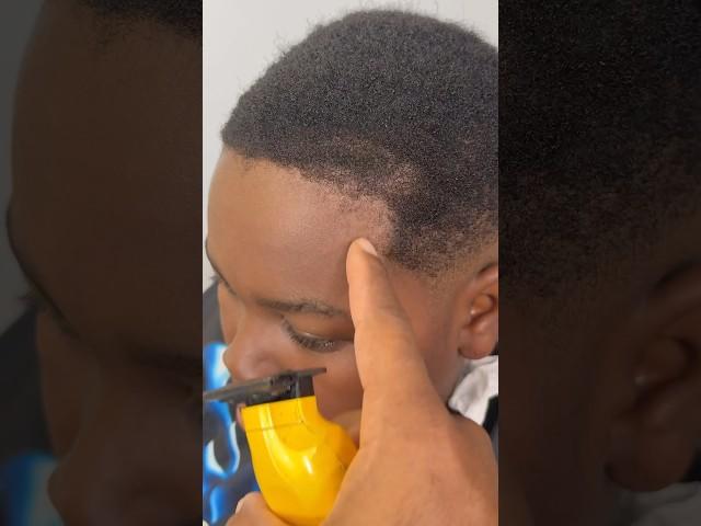 Save His Hairline ⁉️‍️ #barber #hairlinerestoration