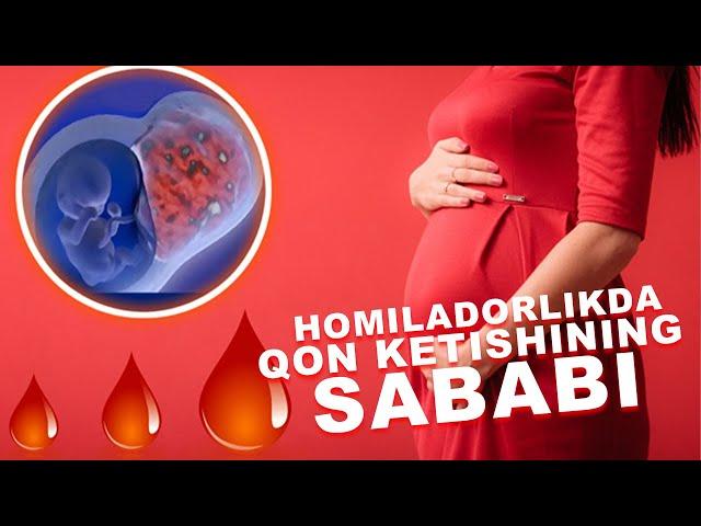 HOMILADORLIKDA QON KETISHINING SABABI | ХОМИЛАДОРЛИКДА КОН КЕТИШИНИНГ САБАБИ