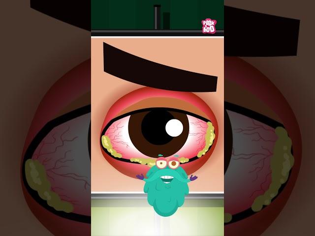 What Is Pink Eye? What Causes Conjunctivitis #shorts #pinkeye #conjunctivitis #drbinocsshow