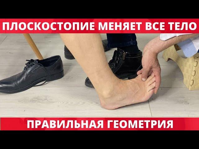 Геометрия ног, плоскостопие меняет все тело | Школа Ног