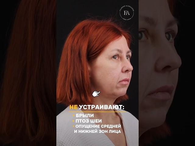 Большой омолаживающий комплекс Ранний результат! Пластический хирург ФИЛИППОВ АЛЕКСАНДР ИГОРЕВИЧ