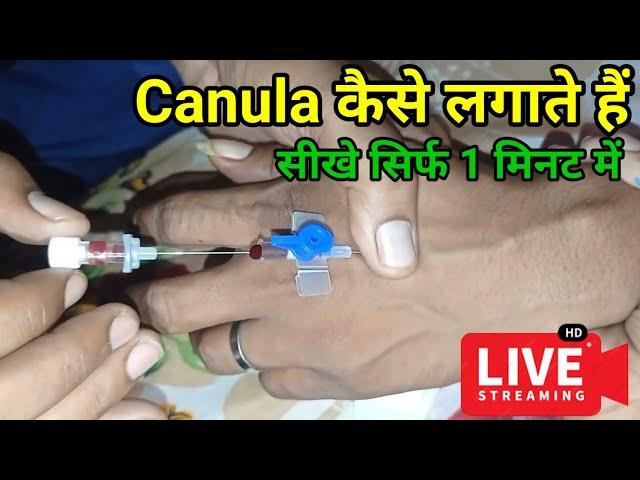 Cannula kaise lagate hain|Cannula insertion technique|Vigo kaise lagaya jata hai|kenula kaise lagaye