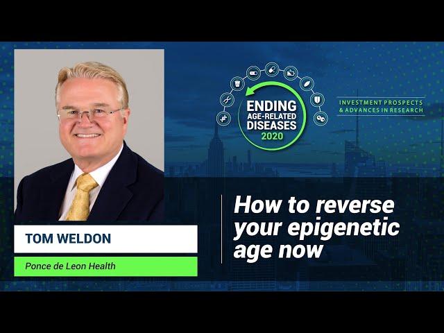 Thomas Weldon | How to Reverse Your Epigenetic Age Now