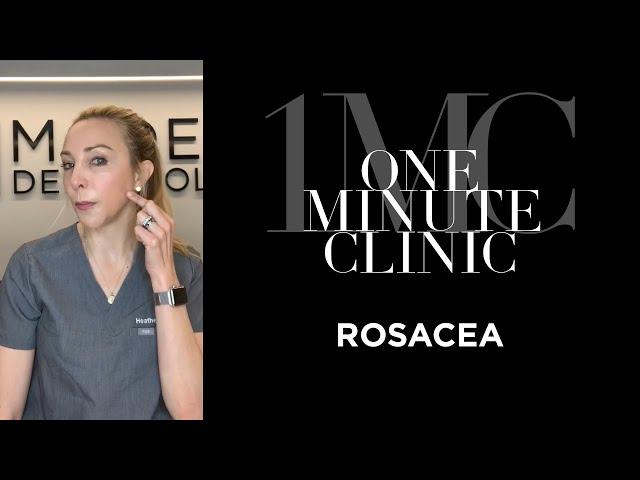 Decoding Rosacea: Essential Insights for a Clear Complexion