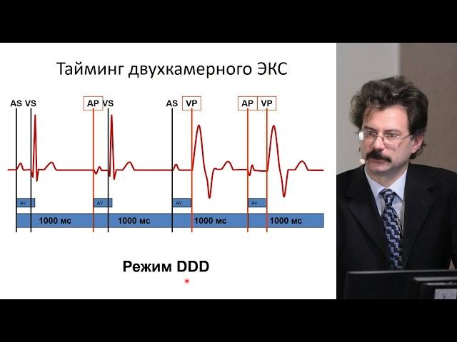 Холтеровское мониторирование пациентов со стимулятором. Часть 1: особенности заключения