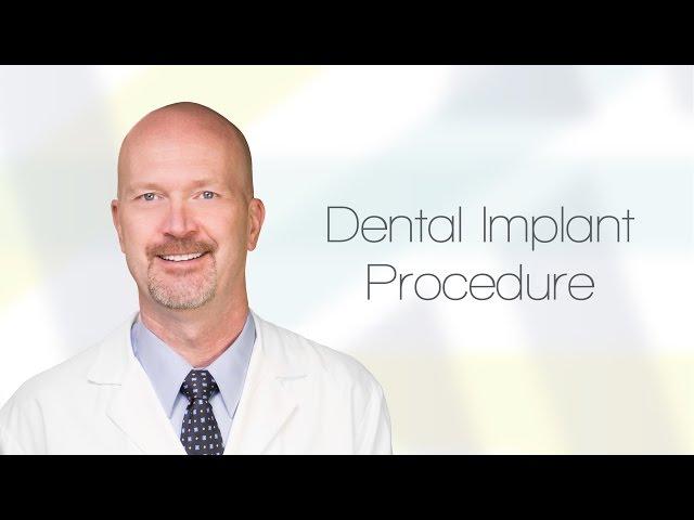 Dental Implant Procedure Info in Odessa TX | Permian Basin Oral Surgery & Dental Implant Center