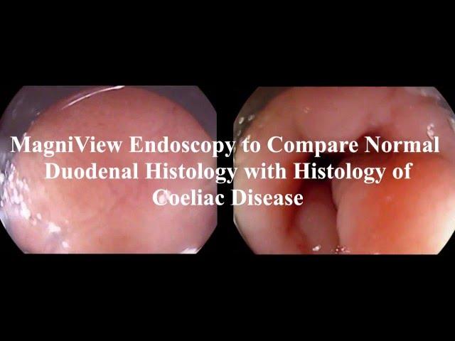 MagniView Endoscopy Splitscreen