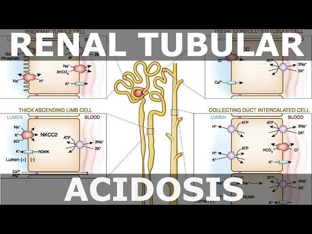 Renal Tubular Acidosis