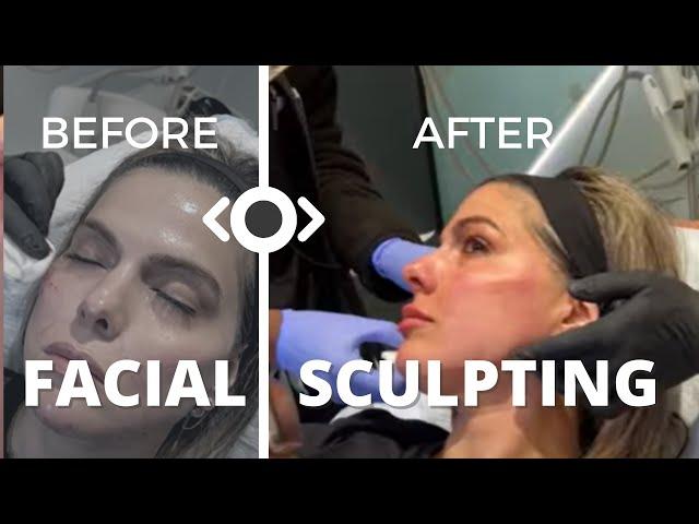 GET SNATCHED AND SCULPTED WITH FEMALE FACIAL SCULPTING | Dr. Jason Emer