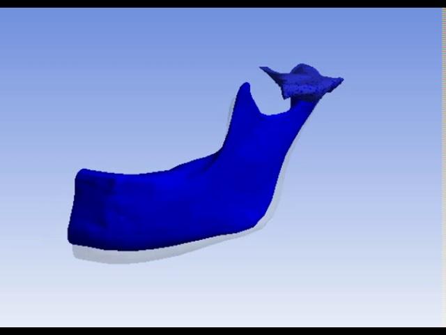 Temporomandibular Joint Ansys Analysis