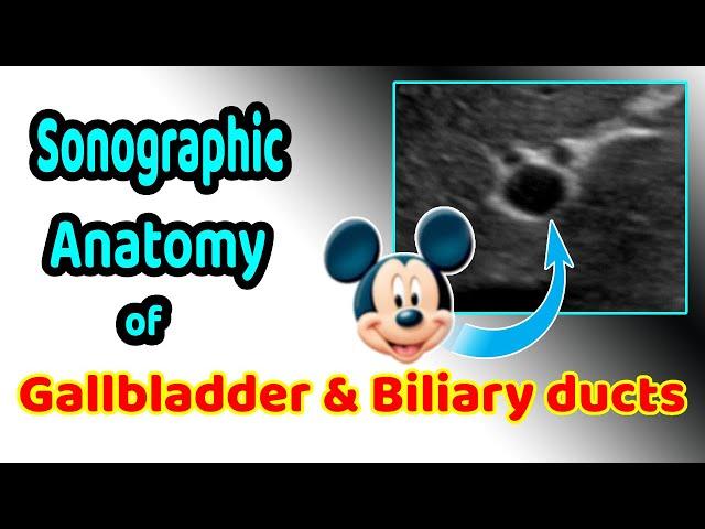 Sonographic anatomy of the gallbladder and biliary ducts