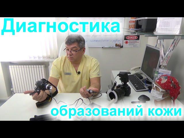 Диагностика образований кожи. Раннее выявление меланомы спасает жизнь.#6