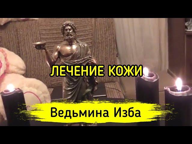 ЛЕЧЕНИЕ КОЖИ. ДЛЯ ВСЕХ ▶️ ВЕДЬМИНА ИЗБА - МАГИЯ