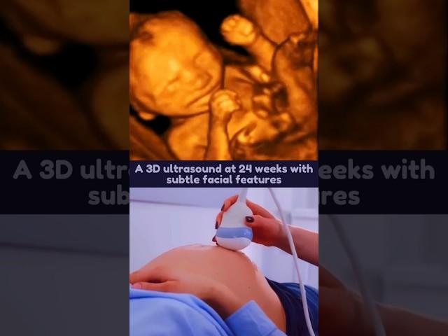 24 Weeks 3D Ultrasound with Facial Details 