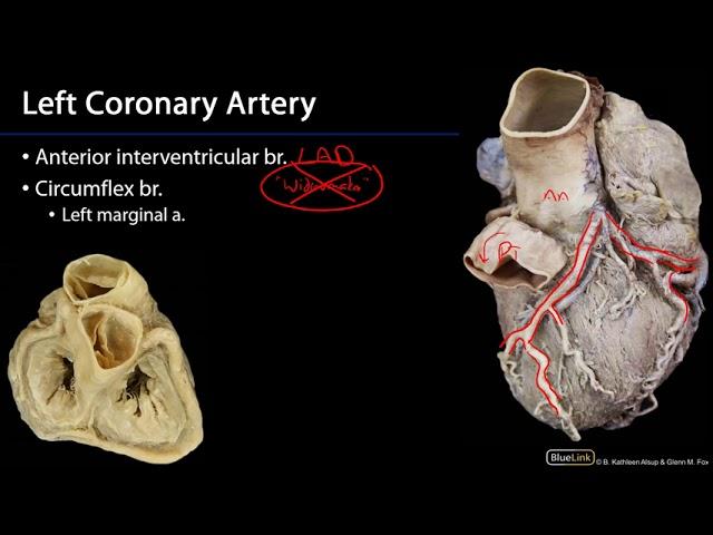 Heart - Coronary Arteries