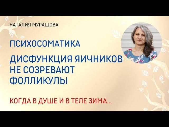 Дисфункция яичников. Не созревают фолликулы.