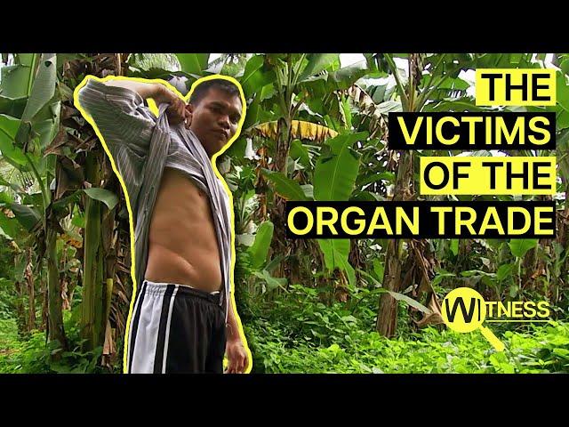 Organ Thieves: Inside the Dark World of Organ Trafficking | Organ Trade Documentary